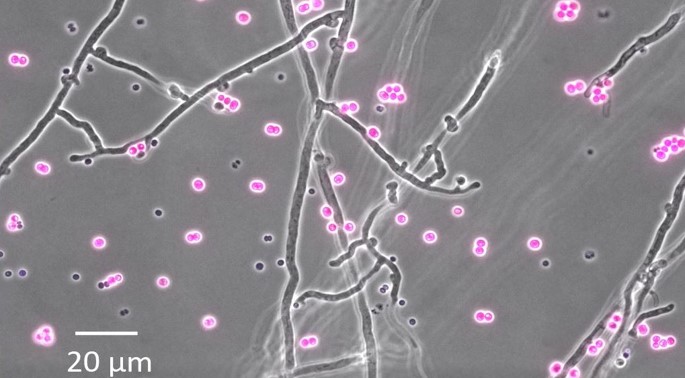 Novel bacterial pH bioreporters allow to assess in vivo the pH of the fungal hyphosphere at the micrometer scale 
(&copy; Bijing Xiong/UFZ) https://rdcu.be/cC5HQ